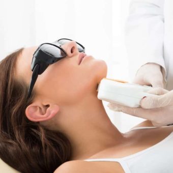 IPL Skin Rejuvenation Neck