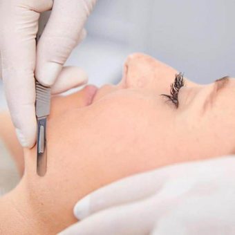 Epidermal Levelling