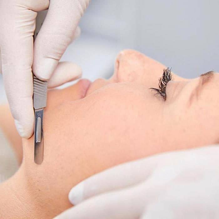 Epidermal Levelling