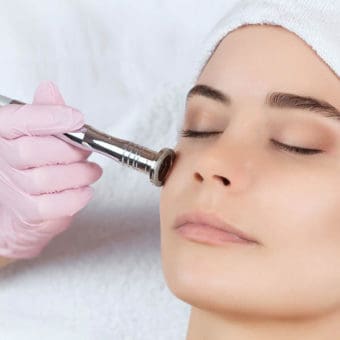 Revive Microdermabrasion