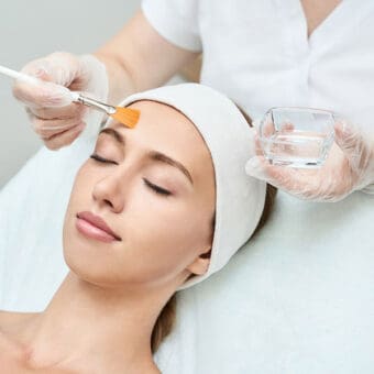 Facial Peels
