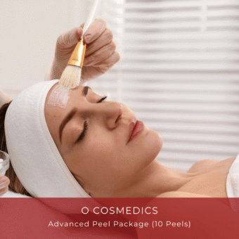 Advanced Peel Package