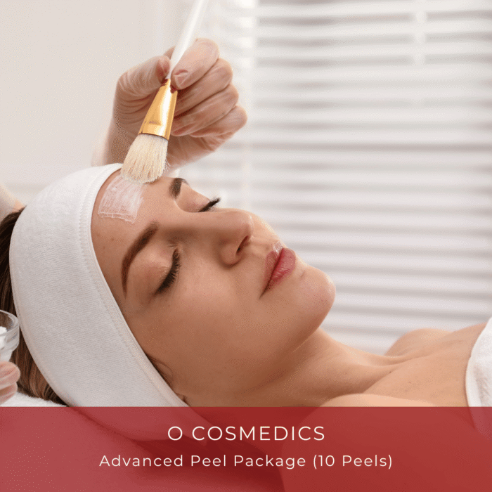 Advanced Peel Package
