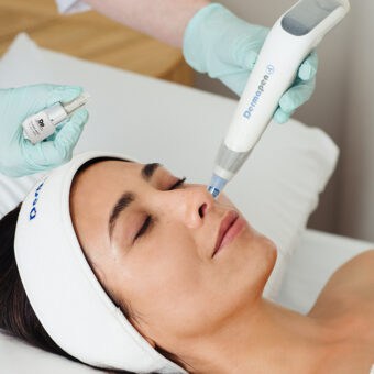 Exosome Skin Needling Pack