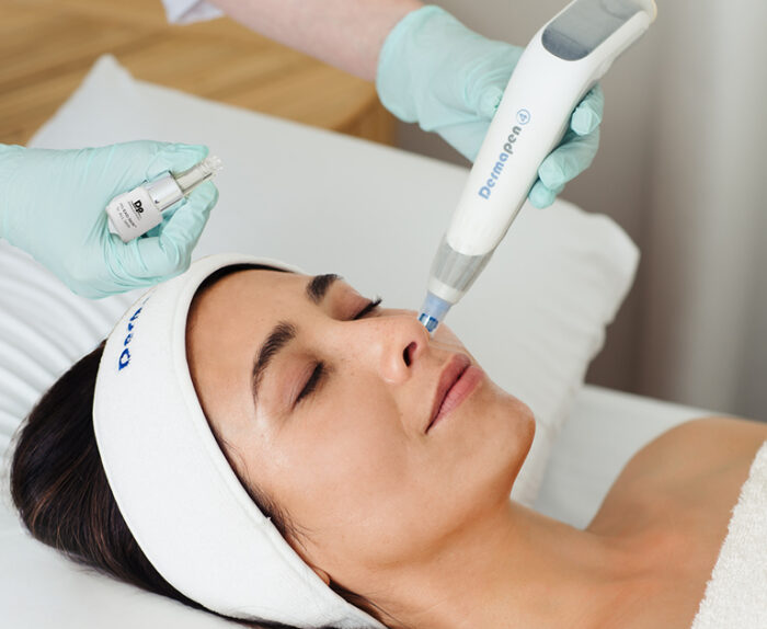 Exosome Skin Needling Pack